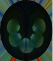 variation22